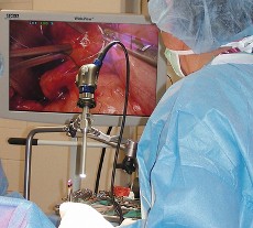 Exoscopios Cirugía